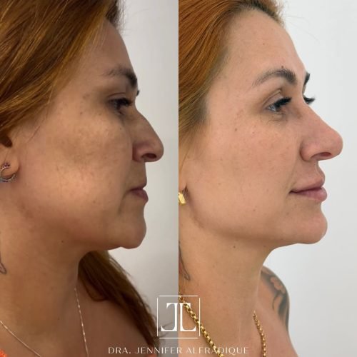 SaveClip.App_483918970_17889160839211613_6351670871112657317_n