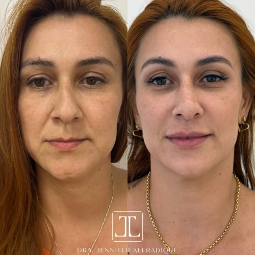 SaveClip.App_484128993_17889160830211613_4367980514901358017_n